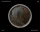 bordetella pertussis culture on charcoal agar